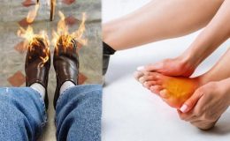 Gece ayak yanmasına ne iyi gelir, ayak altı yanması hangi hastalığın belirtisidir? Ayakaltı yanması nasıl geçer?