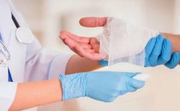 Yanıktan sonra su toplaması nasıl, kaç günde geçer? Yanık su toplaması patlarsa…